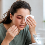 Eye Injury